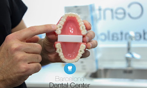 Barcelona Dental Center